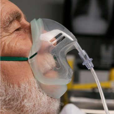 Fractional Exhaled Nitric Oxide